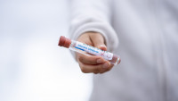 covid test-tube-5065426 1280